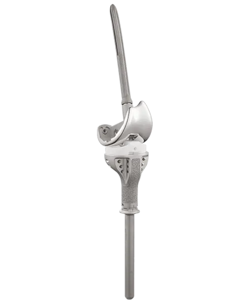 proximal_tibial_replacment_image